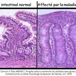 Muqueuse intestinale atteinte.jpg